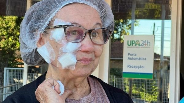 Idosa de 79 anos é atacada por pit bull em São José do Rio Preto e leva 50 pontos no rosto