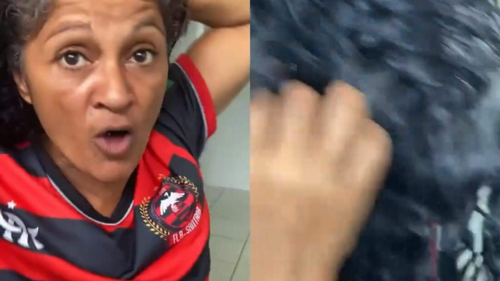 Mulher surpreende ao ser flagrada com gambá escondido no cabelo - Metropolitana FM