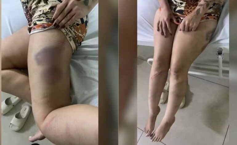 Jovem é agredida e mantida em cárcere privado por ex-namorado em Catanduva (SP)